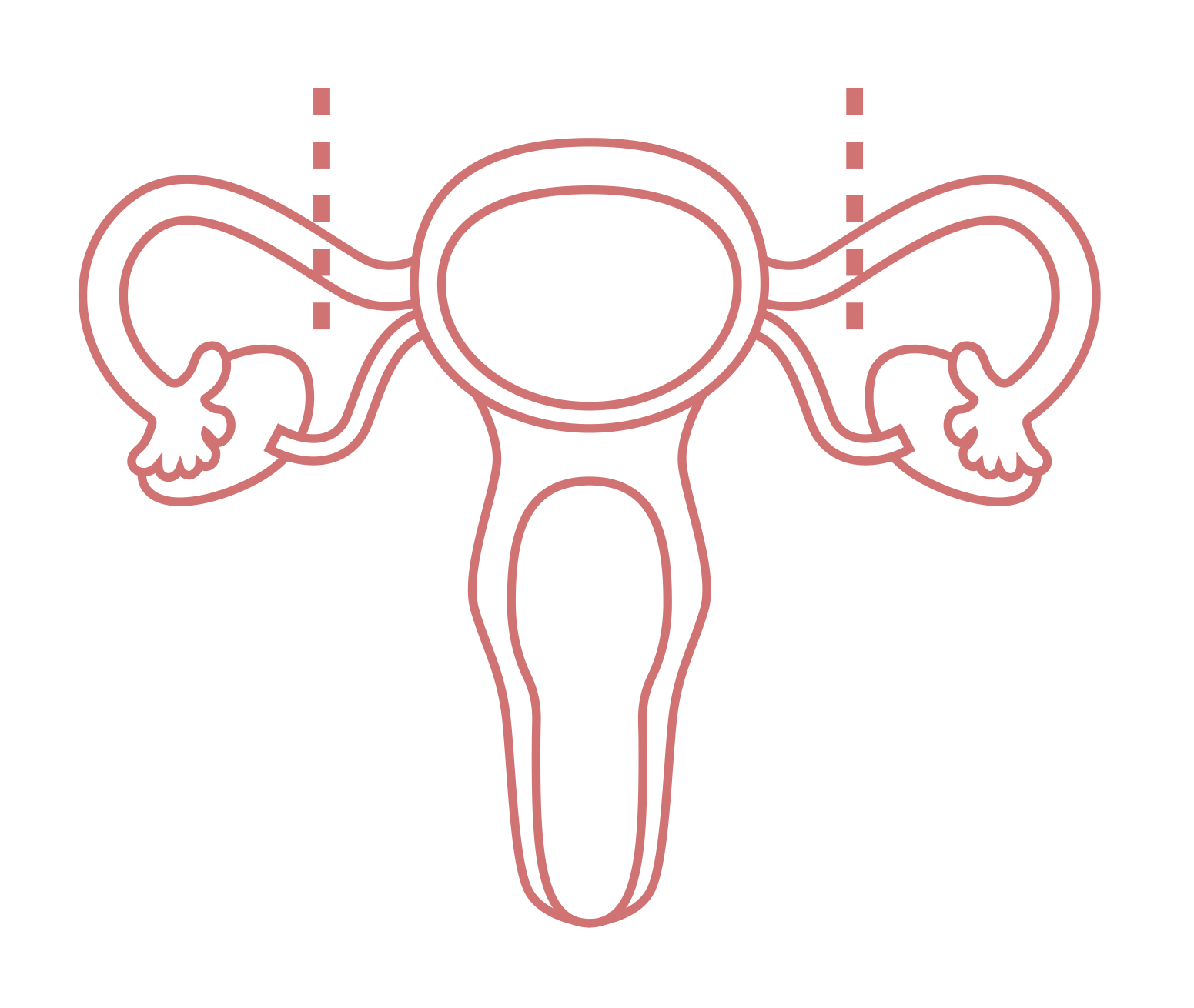 Illu_Zwangssterilisation