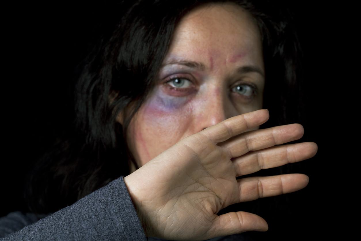 Frau mit blauem Auge